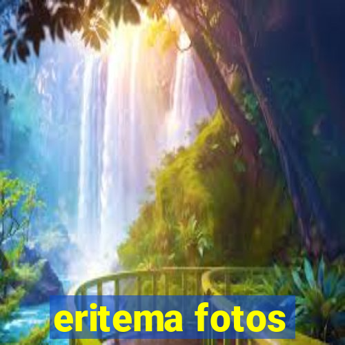 eritema fotos