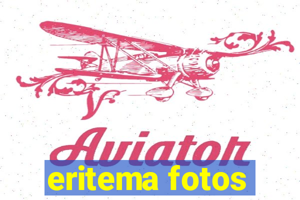 eritema fotos